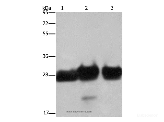 Western Blot analysis of Human adrenal pheochromocytoma, fetal muscle and skeletal muscle tissue   using FHL1 Polyclonal Antibody at dilution of 1:500