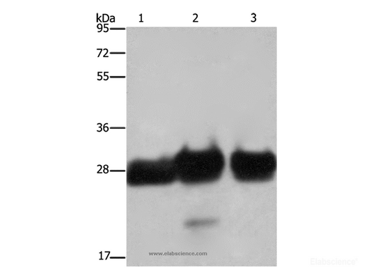 Western Blot analysis of Human adrenal pheochromocytoma, fetal muscle and skeletal muscle tissue   using FHL1 Polyclonal Antibody at dilution of 1:500