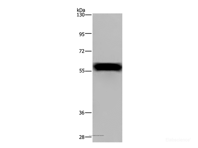Western Blot analysis of Mouse heart tissue using FGB Polyclonal Antibody at dilution of 1:1000