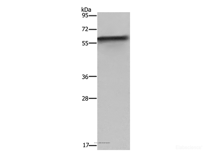 Western Blot analysis of Mouse liver tissue using FKBP8 Polyclonal Antibody at dilution of 1:1150