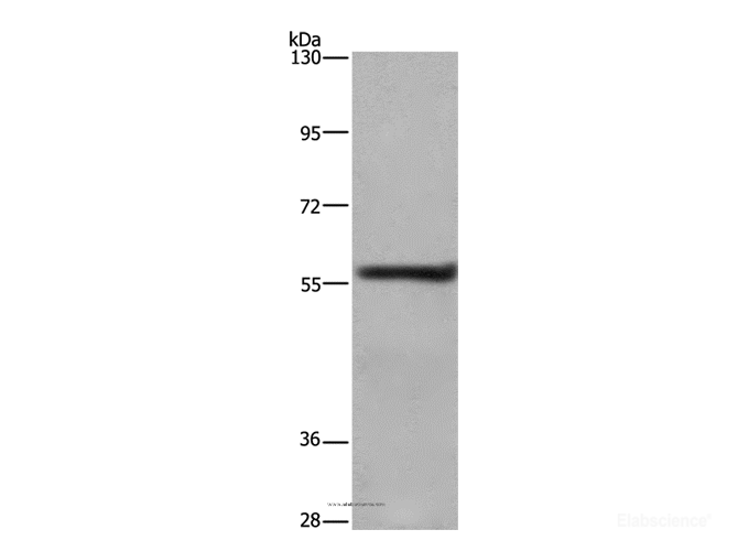 Western Blot analysis of A431 cell using FRK Polyclonal Antibody at dilution of 1:1000