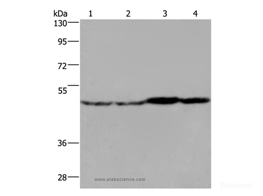Western Blot analysis of Mouse liver, brain and heart tissue, RAW264.7 cell using FH Polyclonal Antibody at dilution of 1:850