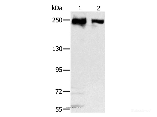 Western Blot analysis of Hela and 293T cell using MCM3AP Polyclonal Antibody at dilution of 1:350