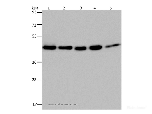 Western Blot analysis of 231, A431, Raji, Jurkat and HepG2 cell using HSP40-4 Polyclonal Antibody at dilution of 1:500