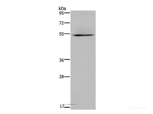 Western Blot analysis of Human kidney tissue using HYAL3 Polyclonal Antibody at dilution of 1:400