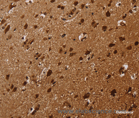Immunohistochemistry of paraffin-embedded Human brain tissue using KARS Polyclonal Antibody at dilution 1:30