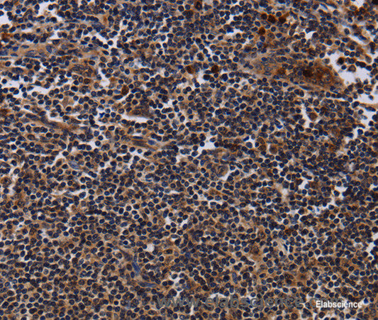 Immunohistochemistry of paraffin-embedded Human tonsil tissue using NTMT1 Polyclonal Antibody at dilution 1:40