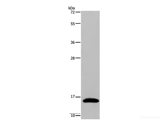 Western Blot analysis of Mouse pancreas tissue using REG3G Polyclonal Antibody at dilution of 1:400