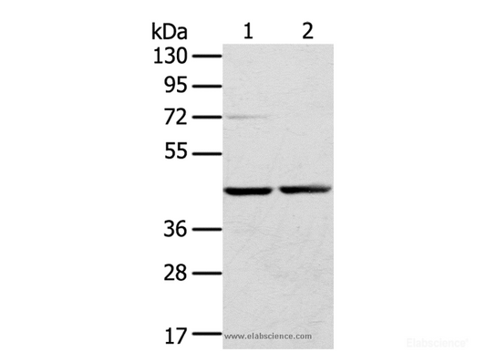 Western Blot analysis of Hepg2 and hela cell using RRAGA Polyclonal Antibody at dilution of 1:400