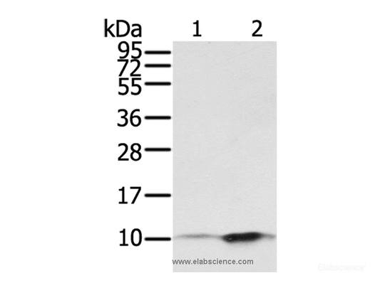Western Blot analysis of A431 and hela cell using S100P Polyclonal Antibody at dilution of 1:650