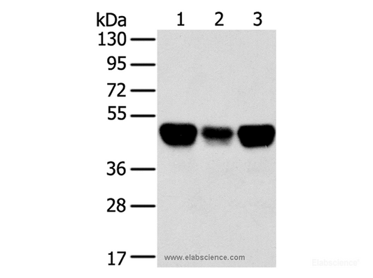 Western Blot analysis of Lovo, A549 and hela cell using TRIM21 Polyclonal Antibody at dilution of 1:400