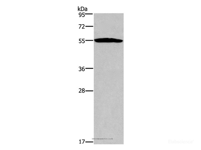 Western Blot analysis of Human serum solution     using SERPINA1 Polyclonal Antibody at dilution of 1:250