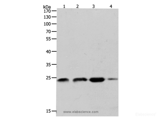 Western Blot analysis of K562, 231 and Hela cell, Human fetal brain tissue using RHOA Polyclonal Antibody at dilution of 1:400