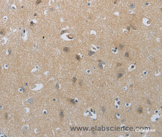 Immunohistochemistry of paraffin-embedded Human brain tissue using NPR1 Polyclonal Antibody at dilution of 1:30