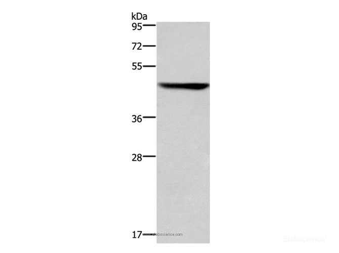 Western Blot analysis of Hela cell using CK-16 Polyclonal Antibody at dilution of 1:450