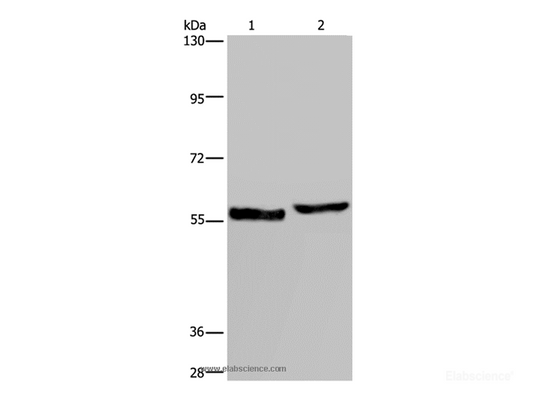 Western Blot analysis of Human testis tissue and A375 cell using SLC1A6 Polyclonal Antibody at dilution of 1:400