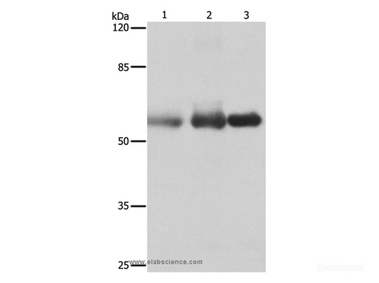 Western Blot analysis of Human cervical cancer, legs fibrous histiocytoma and fetal brain tissue using NECTIN1 Polyclonal Antibody at dilution of 1:400