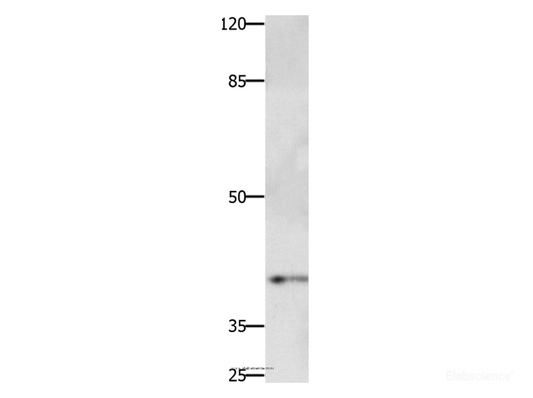 Western Blot analysis of Jurkat cell using PTGER1 Polyclonal Antibody at dilution of 1:500