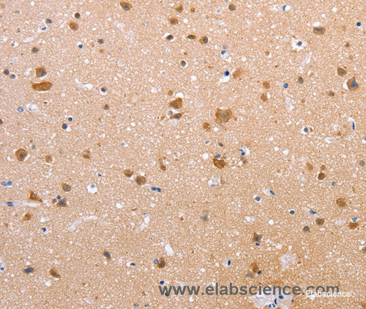 Immunohistochemistry of paraffin-embedded Human brain tissue using Claudin 10 Polyclonal Antibody at dilution 1:50