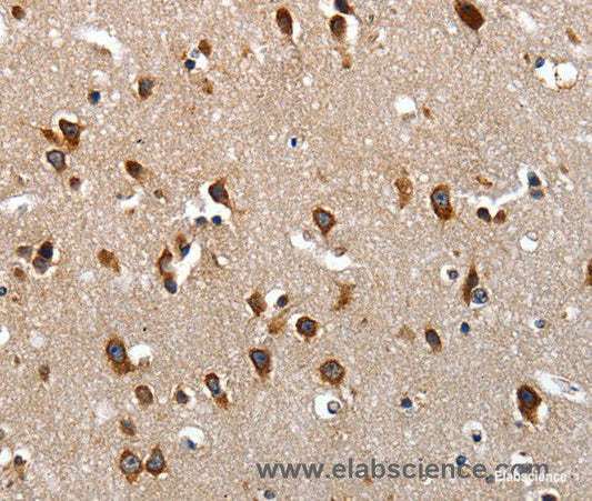 Immunohistochemistry of paraffin-embedded Human brain tissue using LAMA1 Polyclonal Antibody at dilution of 1:70