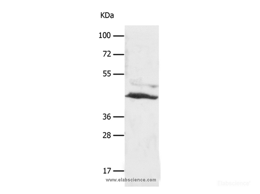 Western Blot analysis of A549 cell using SLC16A7 Polyclonal Antibody at dilution of 1:450