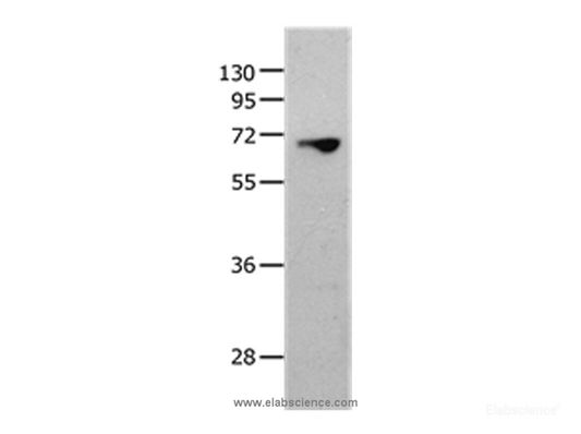 Western Blot analysis of 823 cell using MMP25 Polyclonal Antibody at dilution of 1:1300