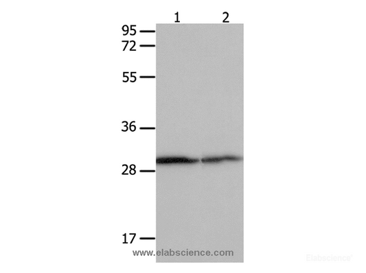 Western Blot analysis of Hela cell and Mouse kidney tissue  using 14-3-3 beta/alpha Polyclonal Antibody at dilution of 1:550