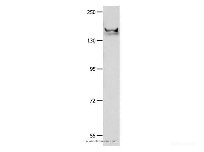 Western Blot analysis of Mouse brain tissue   using GRIN2B Polyclonal Antibody at dilution of 1:700