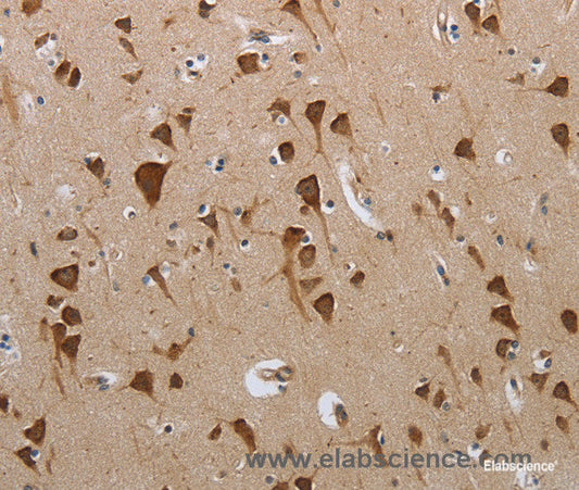 Immunohistochemistry of paraffin-embedded Human brain tissue using PMS2 Polyclonal Antibody at dilution 1:50