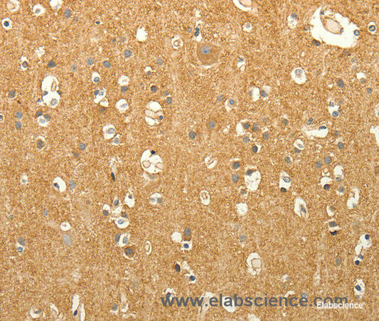 Immunohistochemistry of paraffin-embedded Human brain tissue using EDG7 Polyclonal Antibody at dilution 1:40