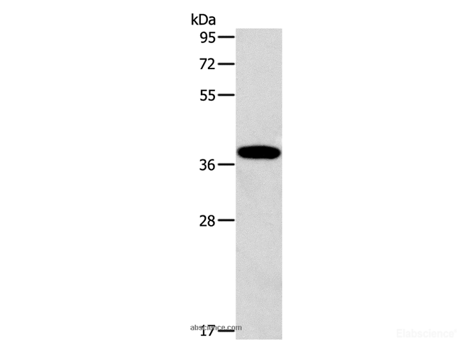 Western Blot analysis of Human fetal liver tissue using ALDOB Polyclonal Antibody at dilution of 1:260