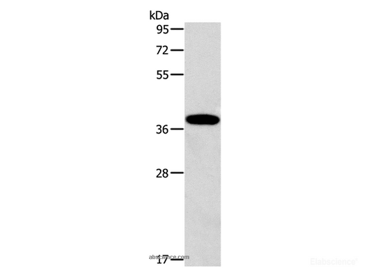 Western Blot analysis of Human fetal liver tissue using ALDOB Polyclonal Antibody at dilution of 1:260
