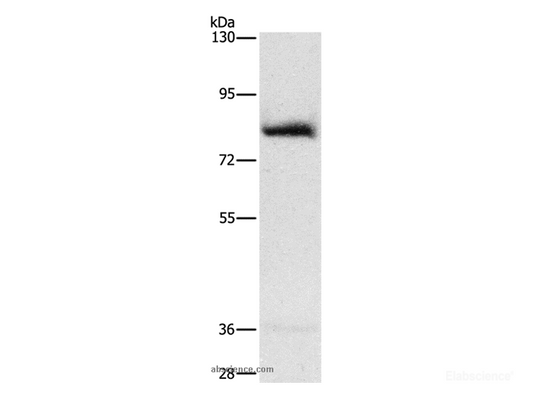 Western Blot analysis of Human fetal muscle tissue using AMPD1 Polyclonal Antibody at dilution of 1:1600