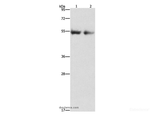 Western Blot analysis of Human right lung and left lung cancer tissue using ANGPT4 Polyclonal Antibody at dilution of 1:480