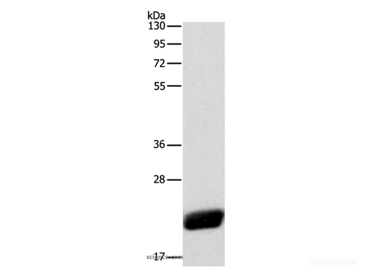 Western Blot analysis of Human leiomyosarcoma tissue using CAV1 Polyclonal Antibody at dilution of 1:525
