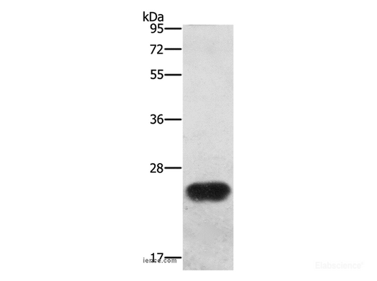 Western Blot analysis of Mouse spleen tissue using BCAS4 Polyclonal Antibody at dilution of 1:1200