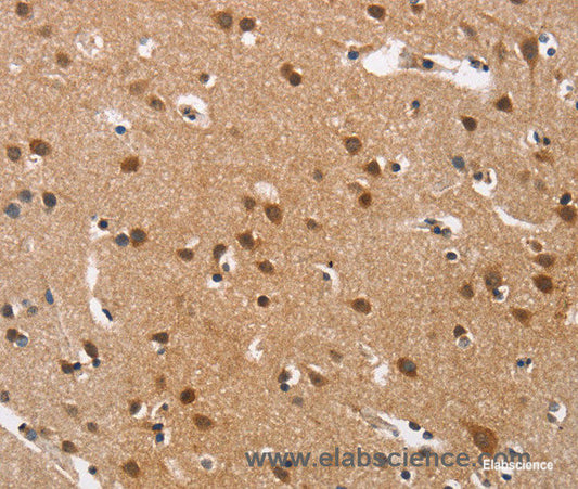 Immunohistochemistry of paraffin-embedded Human brain tissue using Cav1.3 Polyclonal Antibody at dilution 1:40