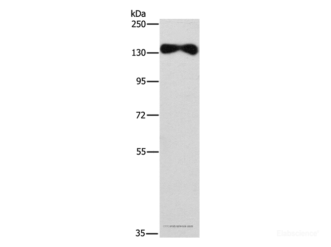 Western Blot analysis of Human placenta tissue using EVC2 Polyclonal Antibody at dilution of 1:450