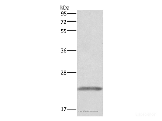 Western Blot analysis of Human placenta tissue   using GH1 Polyclonal Antibody at dilution of 1:500