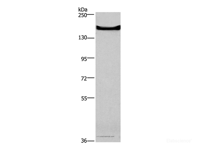 Western Blot analysis of Mouse bladder tissue using GPR124 Polyclonal Antibody at dilution of 1:300