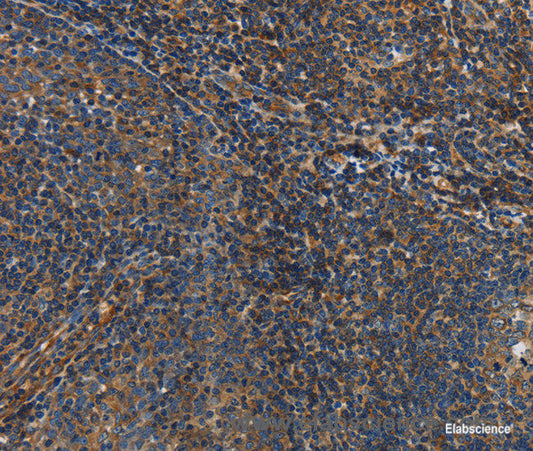 Immunohistochemistry of paraffin-embedded Human tonsil tissue using IL17D Polyclonal Antibody at dilution 1:50