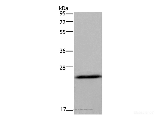 Western Blot analysis of Mouse brain tissue using KCNMB4 Polyclonal Antibody at dilution of 1:500