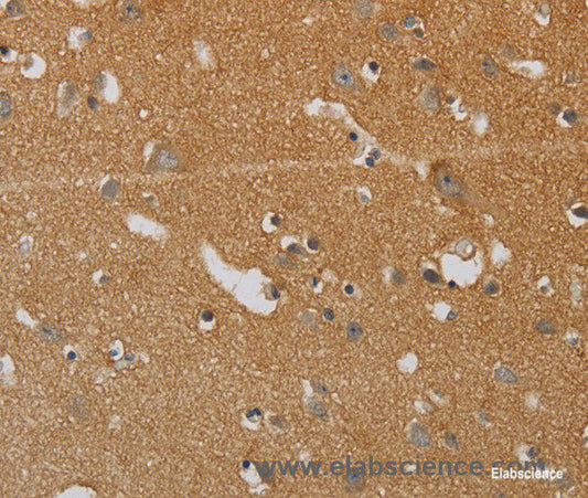 Immunohistochemistry of paraffin-embedded Human brain tissue using KIF4A Polyclonal Antibody at dilution 1:40