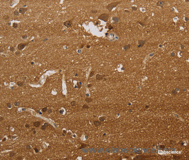 Immunohistochemistry of paraffin-embedded Human brain tissue using ELAVL2 Polyclonal Antibody at dilution 1:40