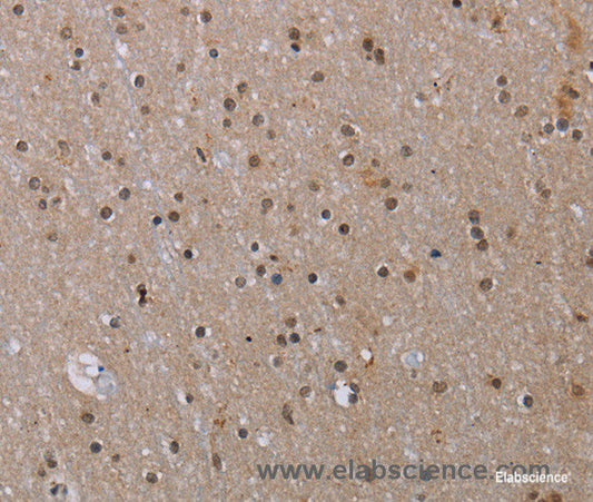 Immunohistochemistry of paraffin-embedded Human brain tissue using MED12 Polyclonal Antibody at dilution 1:40