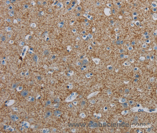 Immunohistochemistry of paraffin-embedded Human brain tissue using PGLYRP1 Polyclonal Antibody at dilution 1:40