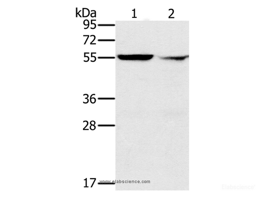 Western Blot analysis of K562 cell and Human fetal liver tissue using PPM1F Polyclonal Antibody at dilution of 1:200