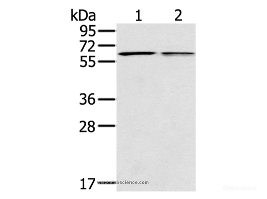 Western Blot analysis of Mouse liver and lung tissue using PTGER2 Polyclonal Antibody at dilution of 1:200