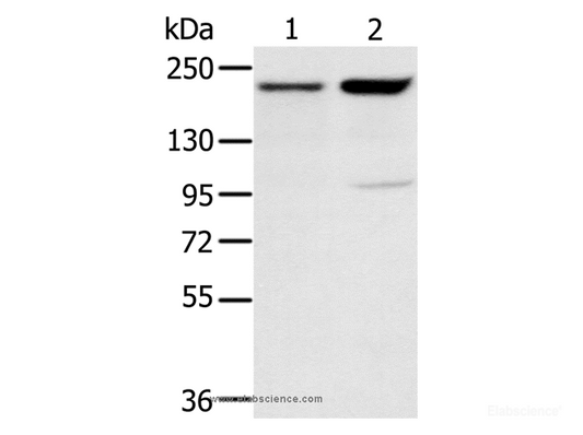 Western Blot analysis of 231 and hela cell using KDM5A Polyclonal Antibody at dilution of 1:200