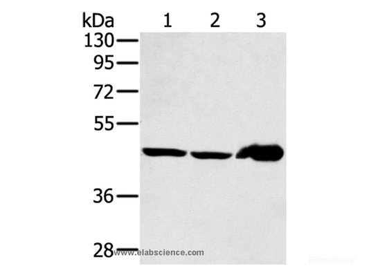 Western Blot analysis of Mouse liver tissue and PC3 cell, Human fetal liver tissue using SEC14L2 Polyclonal Antibody at dilution of 1:400